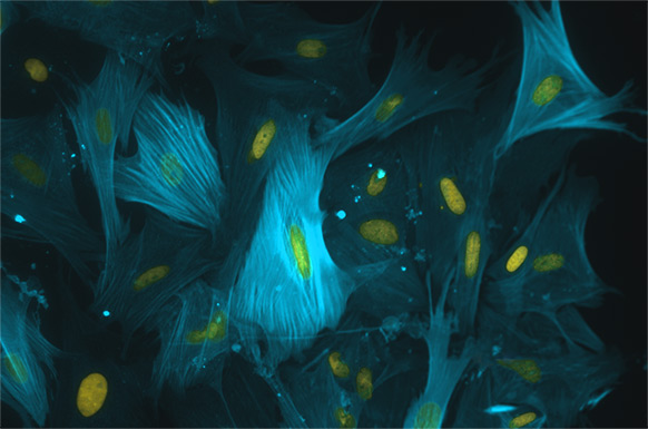 Komórki macierzyste w medycynie regeneracyjnej
